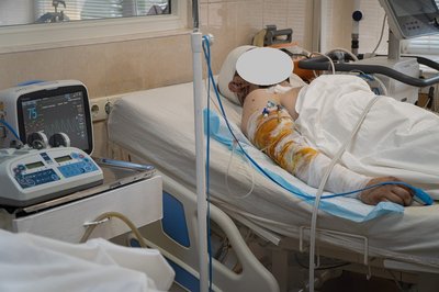 Видалили уламки з мозку, врятували ліве око: лікарі Дніпропетровщини понад дві години оперували пораненого бійця