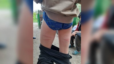 "Він виламав різку і вдарив мене": що відомо про інцидент у школі на Вінниччині "Він виламав різку і вдарив мене": що відомо про інцидент у школі на Вінниччині