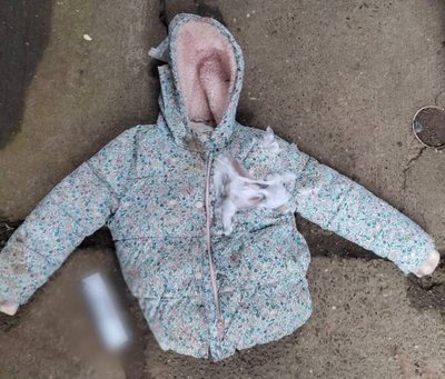 На Київщині собаки втекли з розплідника та покусали матір з 7-річною донькою На Київщині собаки втекли з розплідника та покусали матір з 7-річною донькою