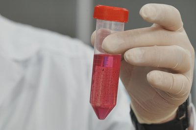 Еквівалент кістки, зроблений на біопринтері Еквівалент кістки, зроблений на біопринтері