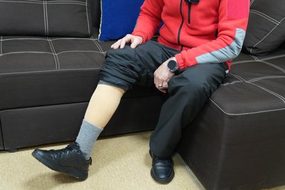 Життя після втрати: як люди на Херсонщині відновлюються після ампутацій через атаки РФ Життя після втрати: як люди на Херсонщині відновлюються після ампутацій через атаки РФ