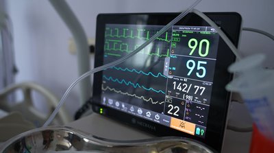 «Звертаються запізно»: скільки випадків інсульту зареєстрували на Черкащині «Звертаються запізно»: скільки випадків інсульту зареєстрували на Черкащині