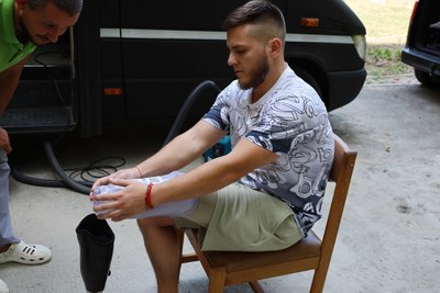 Унікальна методика: у Миколаєві працюватимуть німецькі спеціалісти з протезування