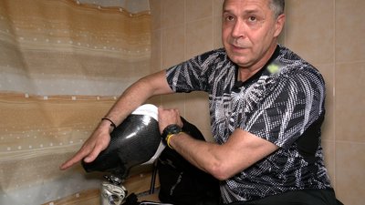 Ветеран Юрій Вєткін розповідає про свої протези ніг та протезування у Чернігові Ветеран Юрій Вєткін розповідає про свої протези ніг та протезування у Чернігові
