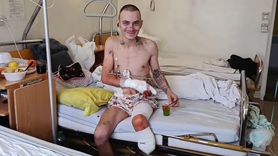 Мій вибір – моя країна: аеророзвідник з Кропивницького після втрати ноги допомагає побратимам Мій вибір – моя країна: аеророзвідник з Кропивницького після втрати ноги допомагає побратимам