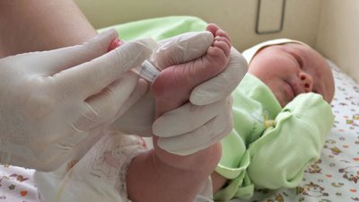 Орфанні хвороби у дітей Орфанні хвороби у дітей