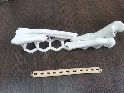 3D модель кістки і пластина 3D модель кістки і пластина