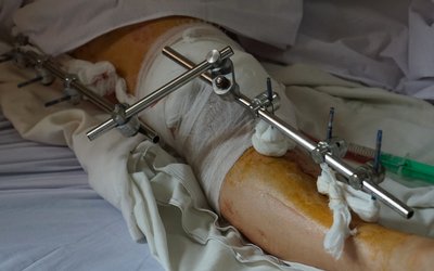 Що відомо про наслідки ракетного удару у Мукачеві Що відомо про наслідки ракетного удару у Мукачеві