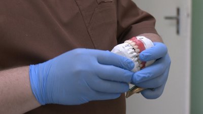 Протезування зубів, військові, Тернопіль, червень 2024 Протезування зубів, військові, Тернопіль, червень 2024