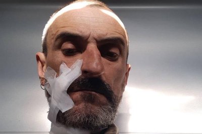 "В мене стріляли російський снайпер та танк". Інтерв’ю з актором Яковом Ткаченко, який пішов воювати "В мене стріляли російський снайпер та танк". Інтерв’ю з актором Яковом Ткаченко, який пішов воювати