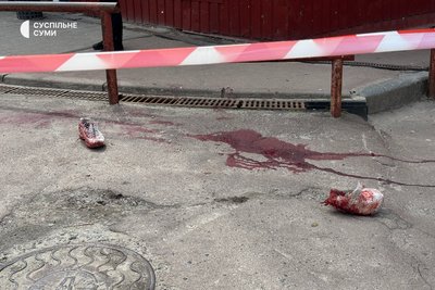 Ножове поранення біля супермаркету в Сумах: чоловік у лікарні Ножове поранення біля супермаркету в Сумах: чоловік у лікарні