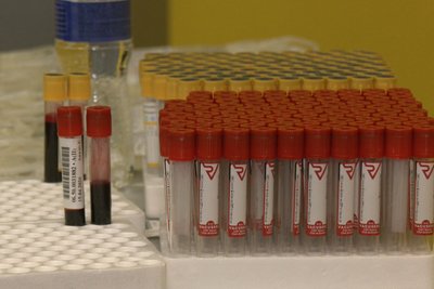 В університеті Житомира влаштували виїзний збір крові В університеті Житомира влаштували виїзний збір крові