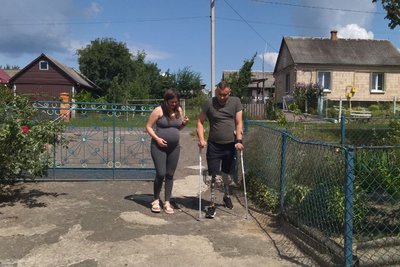 Сергій Копищик з Волині на протезах Сергій Копищик з Волині на протезах