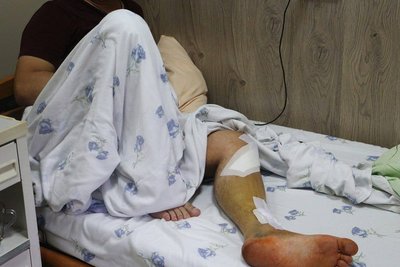 Поранені внаслідок нічної атаки РФ отримали лікування Поранені внаслідок нічної атаки РФ отримали лікування
