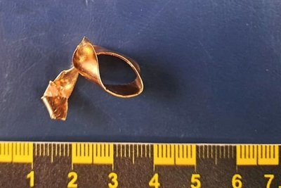 У морзі на Житомирщині з руки полеглого воїна зникла обручка У морзі на Житомирщині з руки полеглого воїна зникла обручка