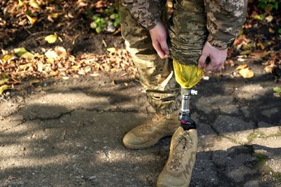 "Ми не ящірки, щоб відростити хвіст". Коригувальник вогню "Фрам" повернувся до війська після ампутації ноги "Ми не ящірки, щоб відростити хвіст". Коригувальник вогню "Фрам" повернувся до війська після ампутації ноги