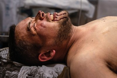 Військовий з перелом ноги у стабілізаційному пункті на Донеччині