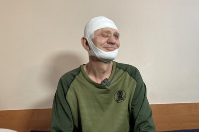 Військовий Олександр Крикуха, якому провели операцію з протезування обличчя Військовий Олександр Крикуха, якому провели операцію з протезування обличчя