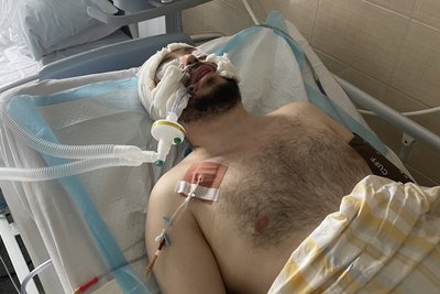 Наслідки ударів РФ, поранили ножем мера П'ятихаток. Головні новини Дніпра та області 26 травня Наслідки ударів РФ, поранили ножем мера П'ятихаток. Головні новини Дніпра та області 26 травня