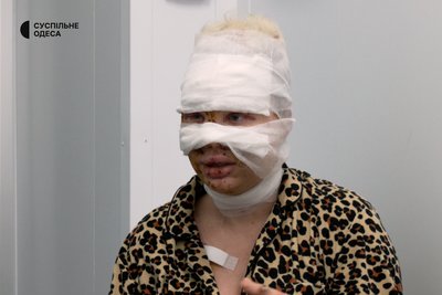 "Багато трупів лежало просто на вулиці" "Багато трупів лежало просто на вулиці"