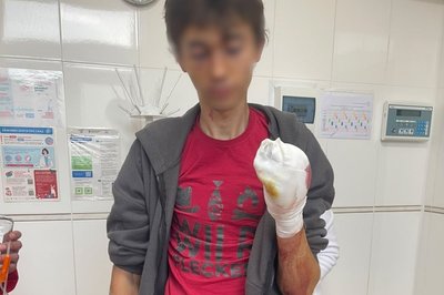 19-річний хлопець, який підірвався на вибухонебезпечному предметі, коли їхав по Прудянці на велосипеді