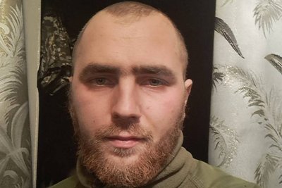 "Можу вулицею пройтися без маски, щоб дітей не травмувати", — бійцю з Волині зробили 5 операцій з відновлення обличчя "Можу вулицею пройтися без маски, щоб дітей не травмувати", — бійцю з Волині зробили 5 операцій з відновлення обличчя