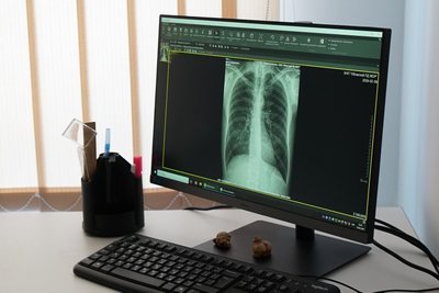 На Житомирщині відкрили оновлене диспансерне відділення обласного протитуберкульозного диспансеру На Житомирщині відкрили оновлене диспансерне відділення обласного протитуберкульозного диспансеру