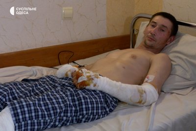 поранений під час ракетного удару по Одесі 14 червня поранений під час ракетного удару по Одесі 14 червня