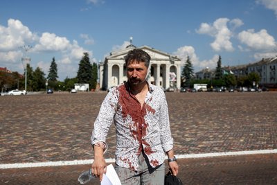 Поранений чоловік через ракетний обстріл Чернігова 19 серпня