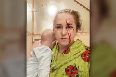 "Вікна летіли нам в обличчя". У Глухові поранені матір та немовля через атаку РФ "Вікна летіли нам в обличчя". У Глухові поранені матір та немовля через атаку РФ
