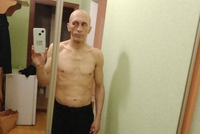 "Три дні без свідомості, 80 уламків у тілі": шлях військовополоненого з Подільська "Три дні без свідомості, 80 уламків у тілі": шлях військовополоненого з Подільська