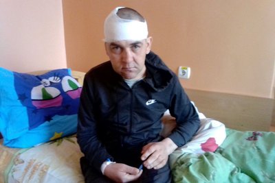 "Почав говорити, але ходити не може", – дружина побитого на Волині солдата. Як це коментують у бригаді "Почав говорити, але ходити не може", – дружина побитого на Волині солдата. Як це коментують у бригаді