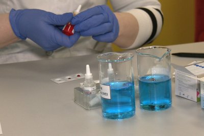 В університеті Житомира влаштували виїзний збір крові В університеті Житомира влаштували виїзний збір крові