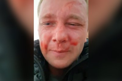 У Житомирі чоловік заявив, що його вдарили в ТЦК: що кажуть в поліції та військкоматі У Житомирі чоловік заявив, що його вдарили в ТЦК: що кажуть в поліції та військкоматі