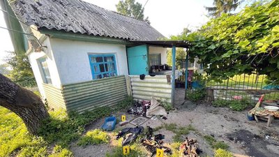 На Хмельниччині жінка під час сварки підпалила співмешканця. Чоловік перебуває у лікарні
