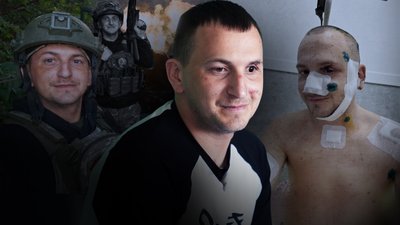Іван Гаргат, травма обличчя, боєць, брат-близнюк, Франківщина