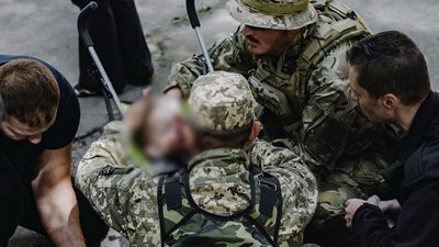 Дворічного хлопчика, який постраждав від вибуху на Валу у Чернігові, збираються везти на лікування до Австрії