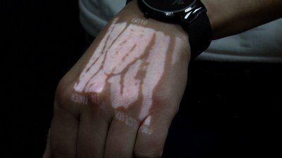 У Житомирській дитячій лікарні з'явився сканер для вен У Житомирській дитячій лікарні з'явився сканер для вен