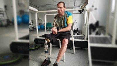 Пережив 69 операцій після поранення: у Львові захиснику виконали реконструкцію обличчя