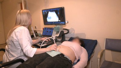 Безкоштовний огляд та діагностика. Як на Івано-Франківщині проводять тиждень обізнаності про рак шийки матки