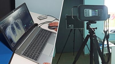 Портативний рентгенапарат