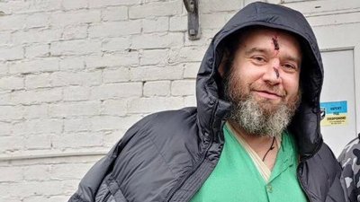 Отримав 10 поранень. Історія добровольця з Дніпра, який пройшов бої на Луганщині, Донеччині та Харківщині Отримав 10 поранень. Історія добровольця з Дніпра, який пройшов бої на Луганщині, Донеччині та Харківщині