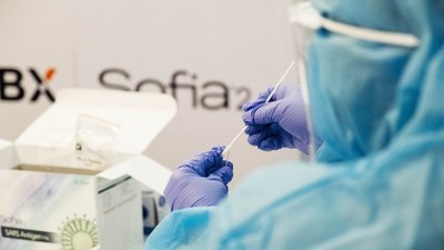 На Житомирщині за добу COVID-19 зареєстрували у 123 жителів області