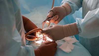 Трупне донорство - чи готові до нього на Запоріжжі. Пояснює експерт
