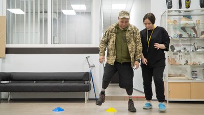 "Люди повертаються до повноцінного життя": як у Дніпрі протезують військових та цивільних "Люди повертаються до повноцінного життя": як у Дніпрі протезують військових та цивільних