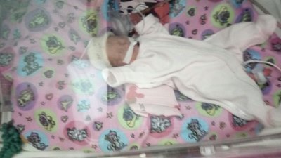 У Чернівцях медики виходили немовля, яке народилось з вагою майже 700 грамів