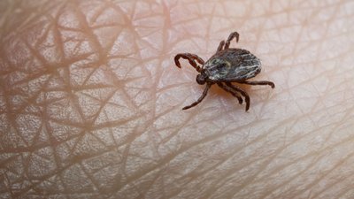 На Полтавщині різко зросла кількість випадків хвороби Лайма: які симптоми та наслідки