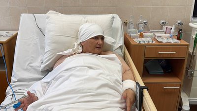 Поранені, Дніпро, Донеччина, лікарня