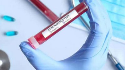 COVID-19 на Хмельниччині — ситуація на 29 червня