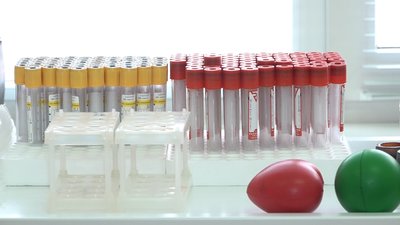 У Житомирі жителі Семенівської громади здали кров для онкохворих дітей У Житомирі жителі Семенівської громади здали кров для онкохворих дітей